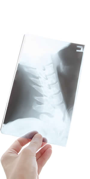X-ray of the spine in guadalajara